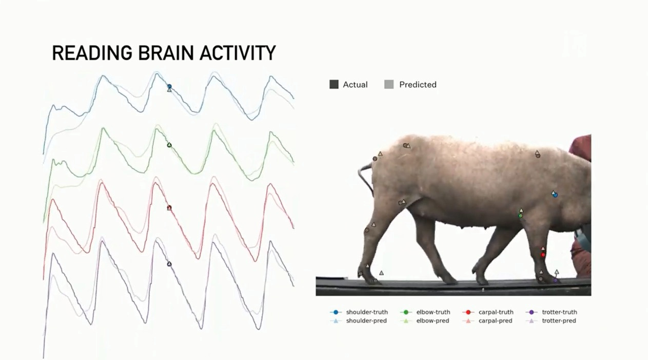 Neuralink