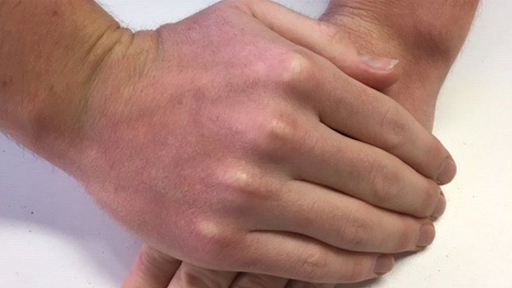 Veri tabanında bulunabilecek örnek bir el fotoğrafı